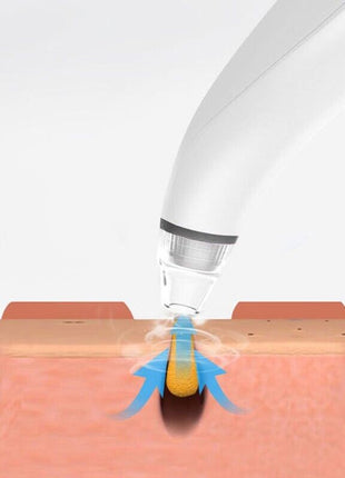 Electric Blackhead Remover Cleaner Face Diamond Pore Vacuum Suction Puce Gaia
