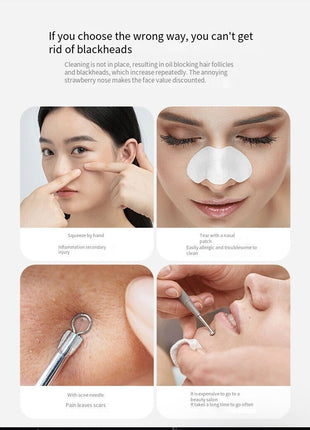 Electric Blackhead Remover Cleaner Face Diamond Pore Vacuum Suction Puce Gaia