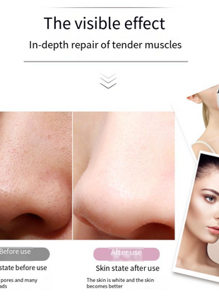 Electric Blackhead Remover Cleaner Face Diamond Pore Vacuum Suction Puce Gaia