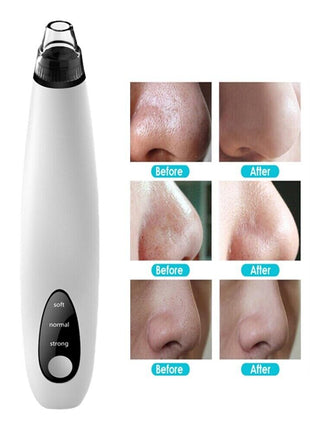 Electric Blackhead Remover Cleaner Face Diamond Pore Vacuum Suction Puce Gaia